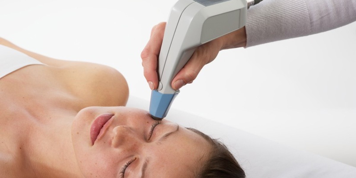 What Is the Ideal Age to Begin Exilis Skin Rejuvenation?
