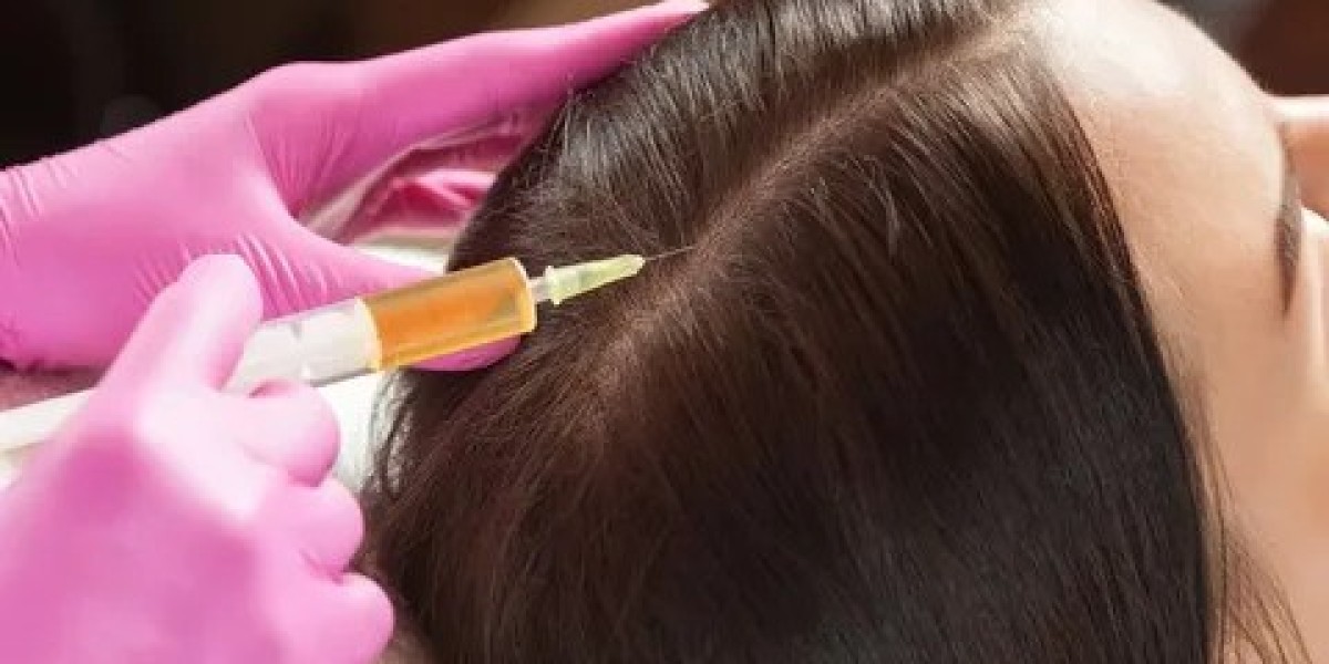 PRP in Islamabad: Effective Hair Loss Treatment