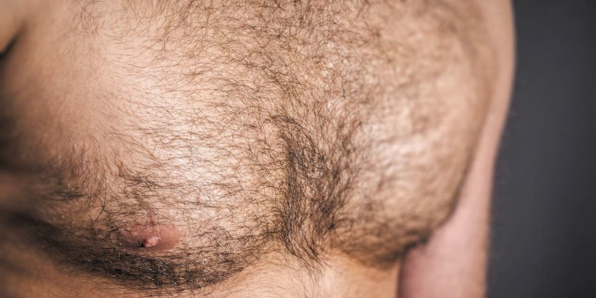 Can Both Men and Women Undergo Body Hair Transplant?