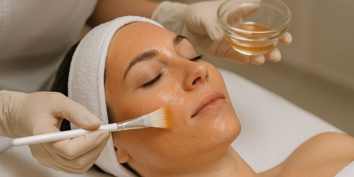 What Is the Typical Cost Range for a Radiance Peel Session?