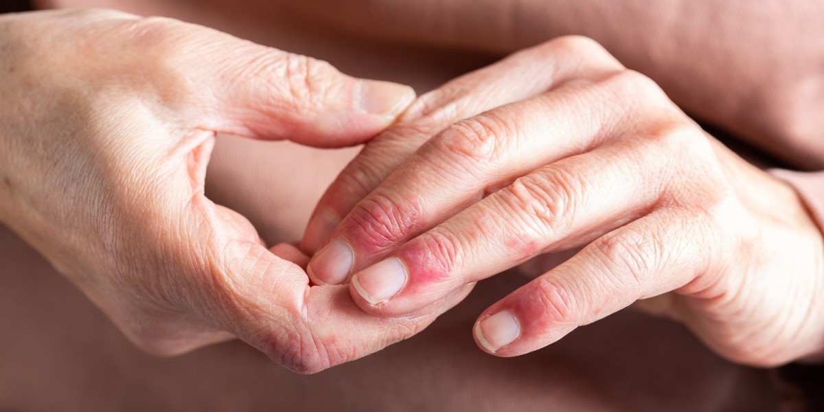 How Stem Cell Therapy Can Treat Autoimmune Diseases