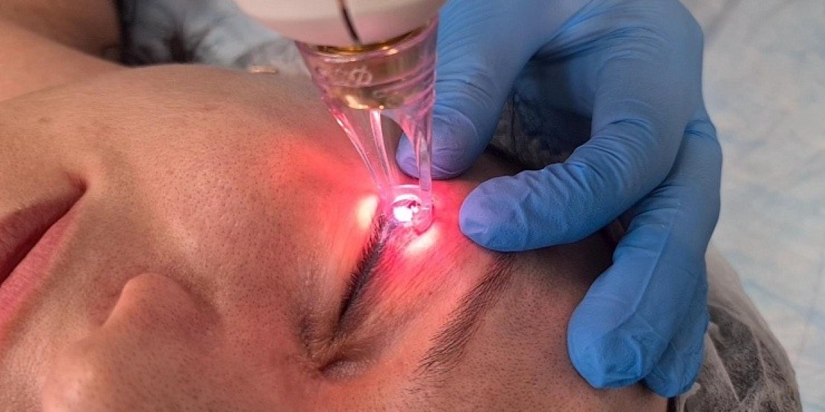 Can Erbium Peel tighten loose or sagging skin?