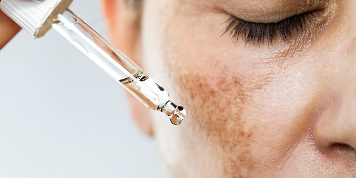 Why Tranexamic Acid Injections in Dubai Are Becoming the Hottest Skin-Brightening Trend