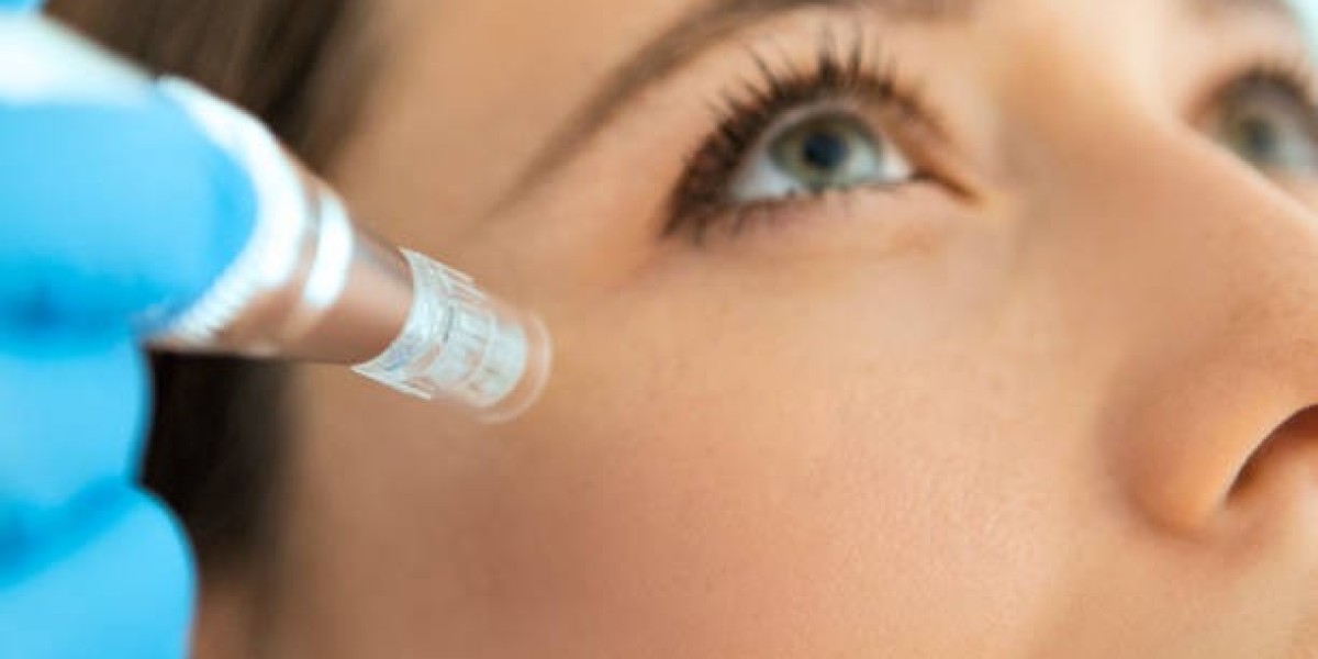 Mesotherapy in Dubai for Youthful Radiance