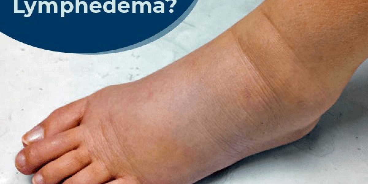 Lymphedema Drugs Market Industry Overview