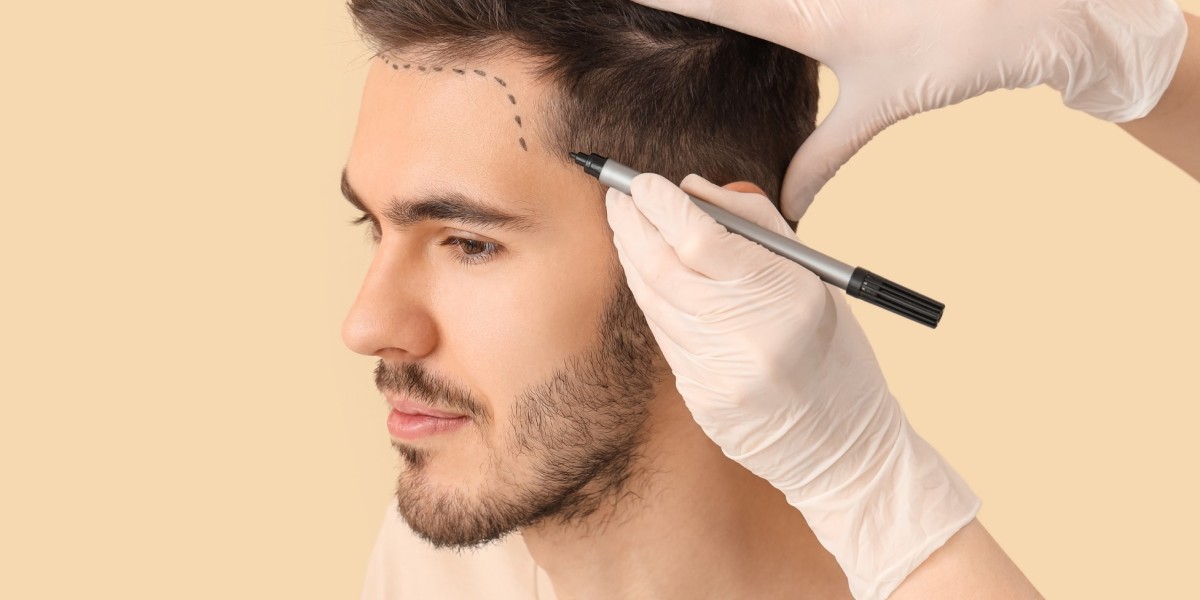 Who Benefits Most from Hair Loss Treatment in Dubai?