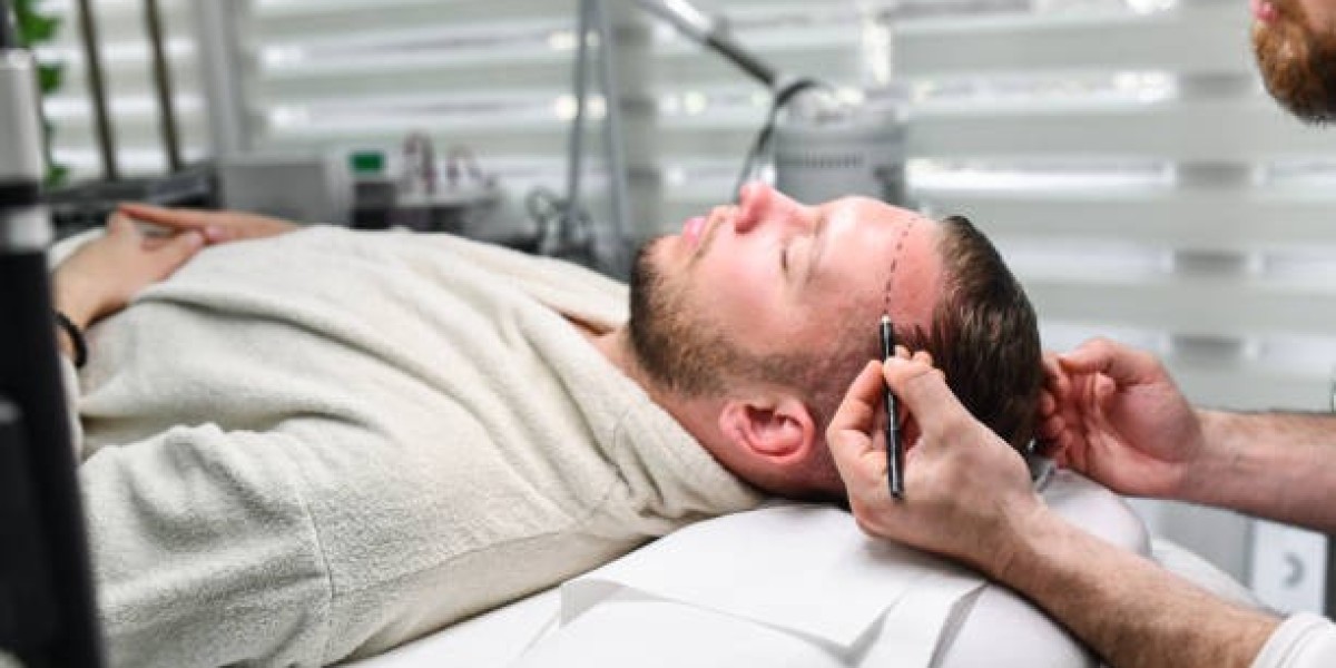 Understanding Hair Transplant Pricing: Clinics, Techniques, and More