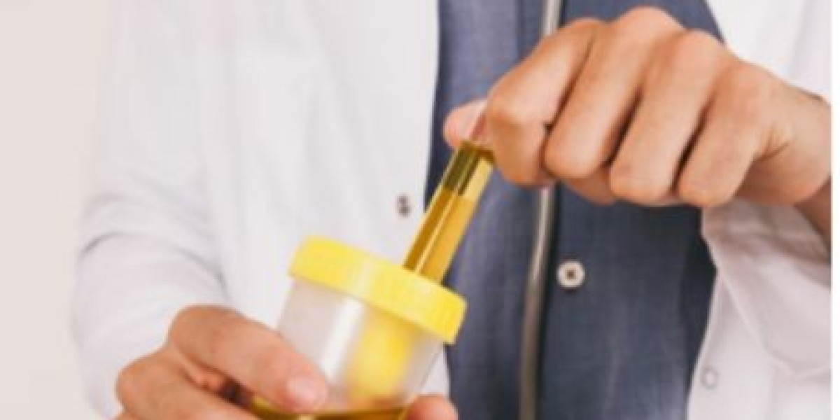Urine Chloride Test: Understanding Your Electrolyte Balance and Kidney Health