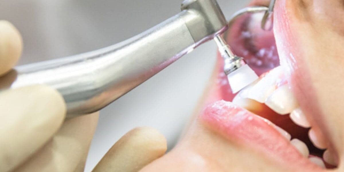 How to Prepare for a Visit to the Best Dental Clinic