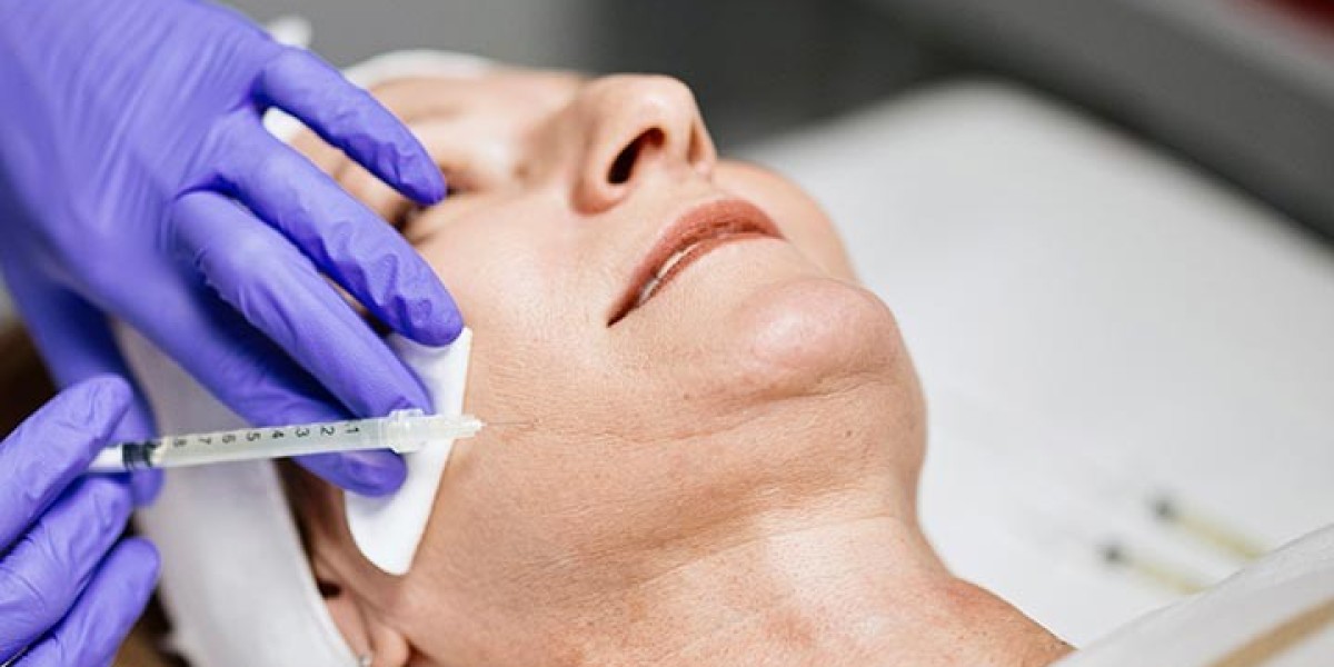Is Sculptra Effective for Treating Deep Wrinkles?