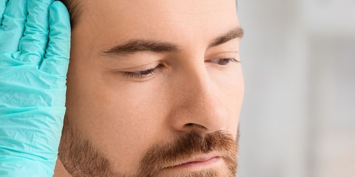 Why PRP Hair Treatment in Dubai Is Preferred Over Hair Transplants
