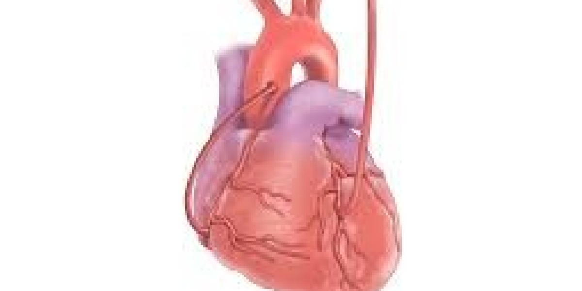 Coronary Artery Bypass Grafts Market Future Prospects and Analysis 2034