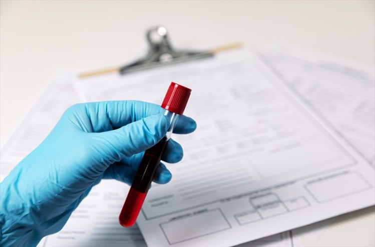Blood Test at home in Dubai