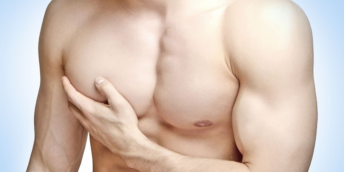 Can Gynecomastia Go Away on Its Own?