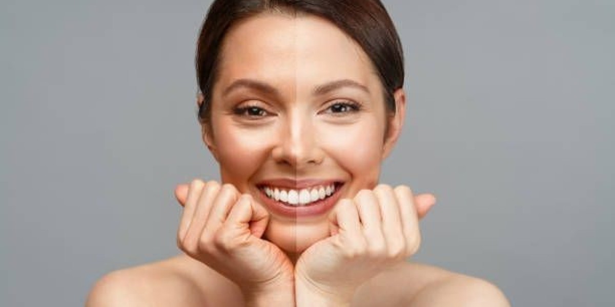 Glutathione Injection for Detoxification: Benefits You Didn’t Know