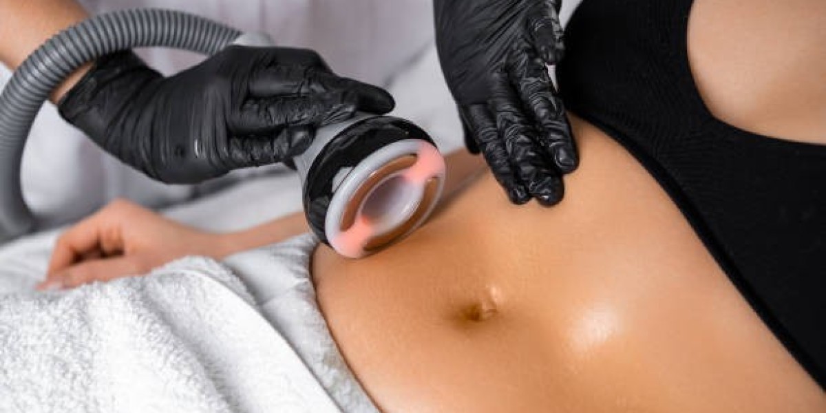 Benefits of Choosing a Body Sculpting Procedure for Body Refinement