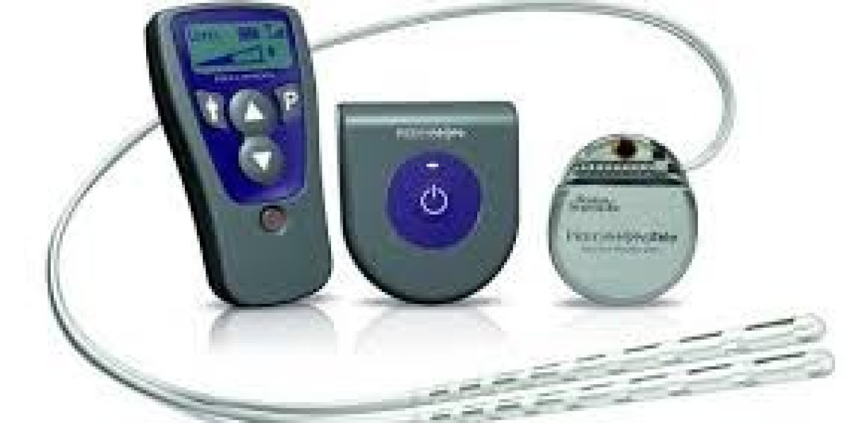 Spinal Cord Stimulation Devices Market Trends and Growth Forecast 2034