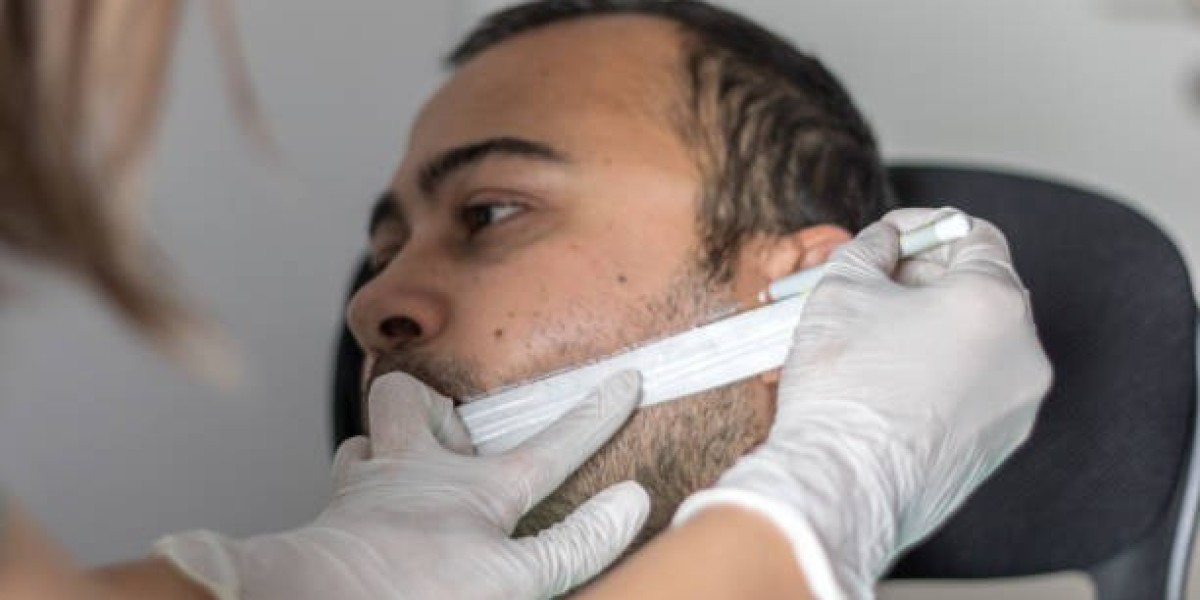 Natural-Looking Beard Transplant in Dubai: Techniques Explained