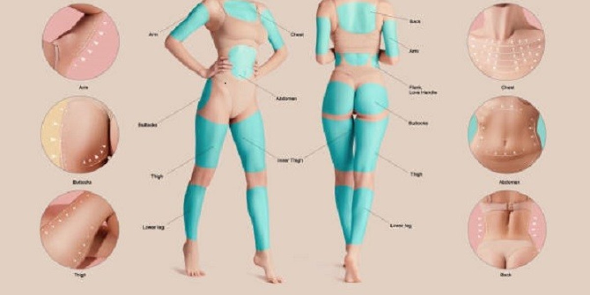 Liposuction in Dubai: 360-Degree Makeover