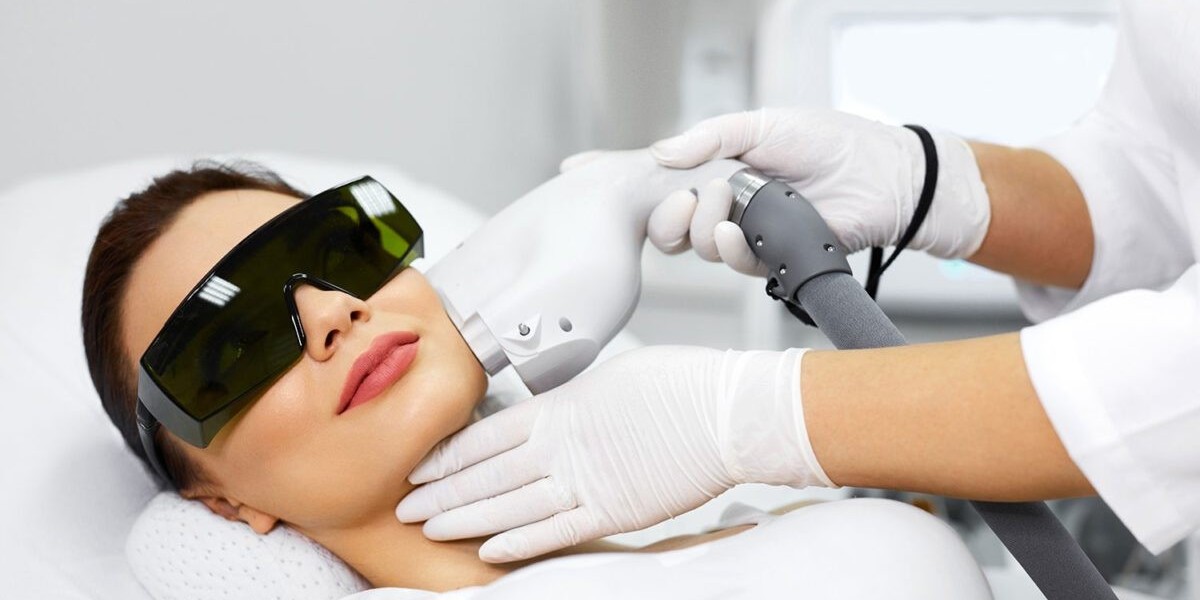 Can Laser Photo Rejuvenation Remove Sunspots and Pigmentation?