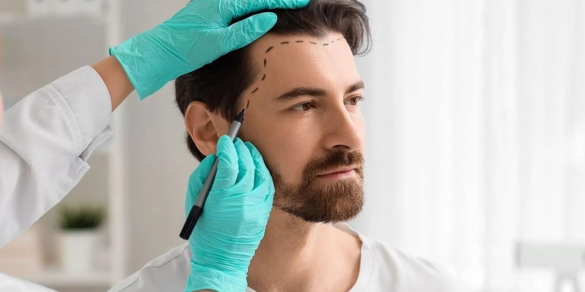 Hair Transplant in Dubai: Understanding the Recovery Timeline