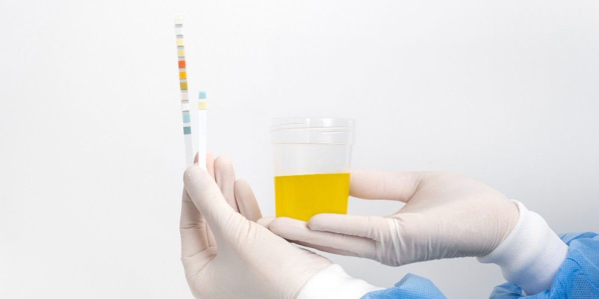 24-HRS-URINE-CATECHOLAMINE Test | 24 Hour Urine Catecholamine Analysis