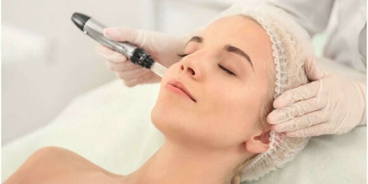 Does midface lift well with Radiofrequency Treatment?
