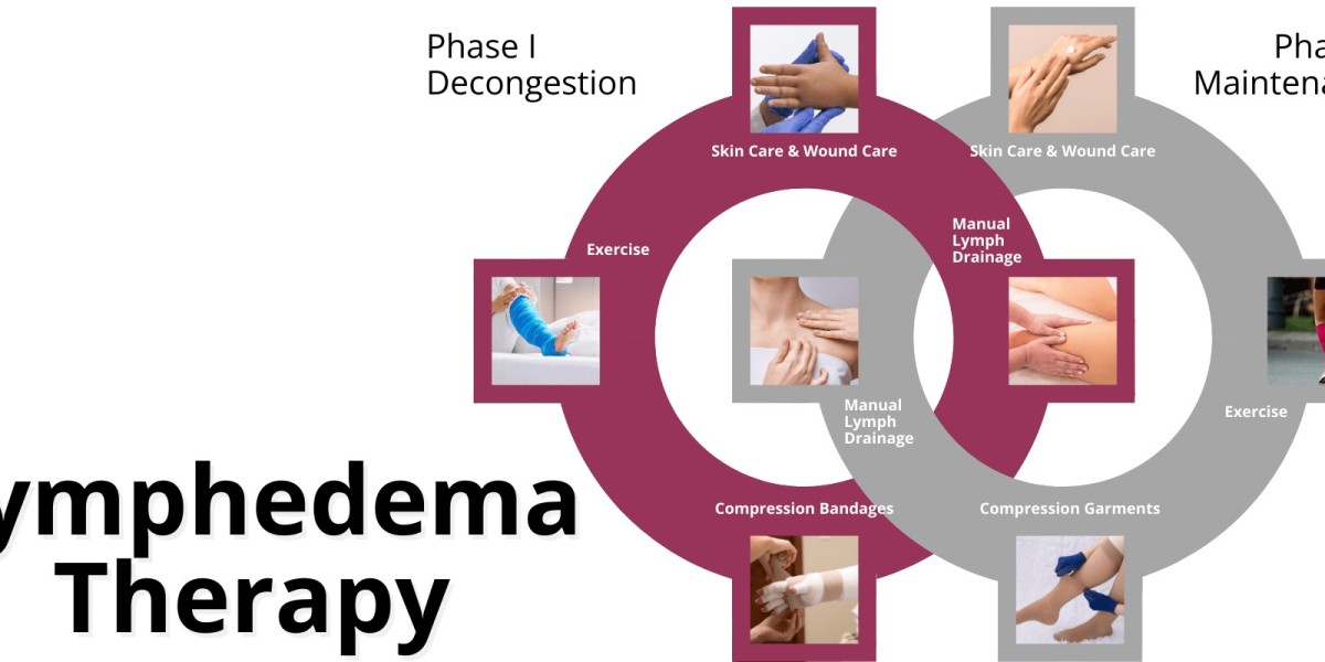 Retinoids Lymphedema Therapy Market Treatment Landscape