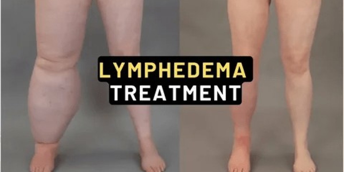Secondary Lymphedema Treatment Market Therapy Landscape