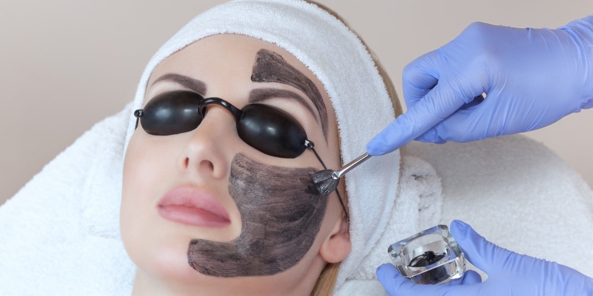 How Often Should You Get a Laser Carbon Peel?