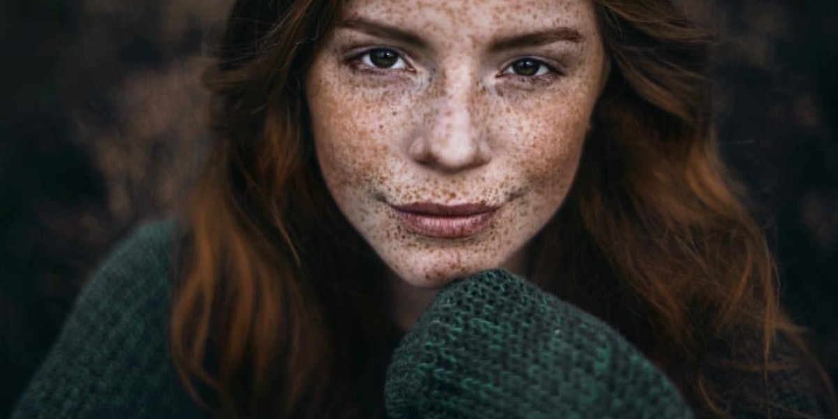 What vitamins help clear freckles and blemishes?