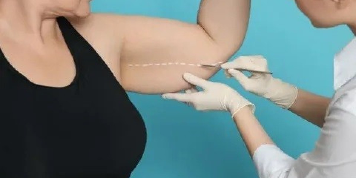 Benefits of Arm Lift Surgery for Toned Arms in Islamabad