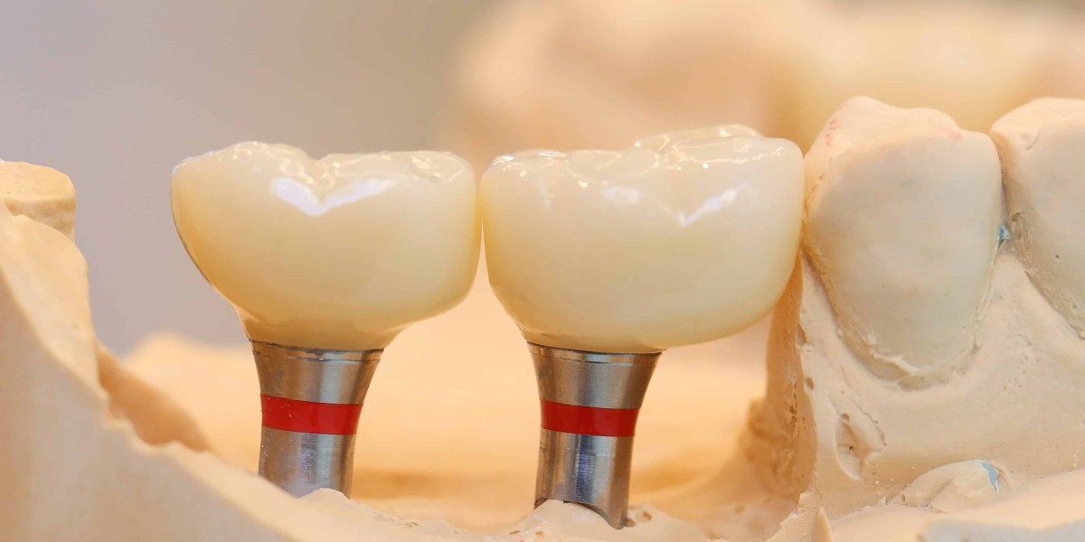 How the Zirconia Crown Procedure Impacts the Overall Cost