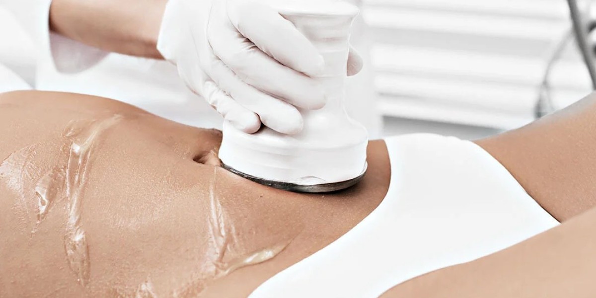 How Safe Is The Best Lipolysis Treatment Option?