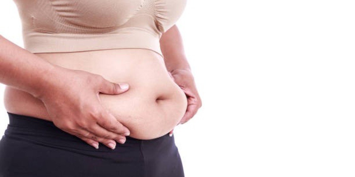 Are Tummy Tuck Results Permanent or Temporary?