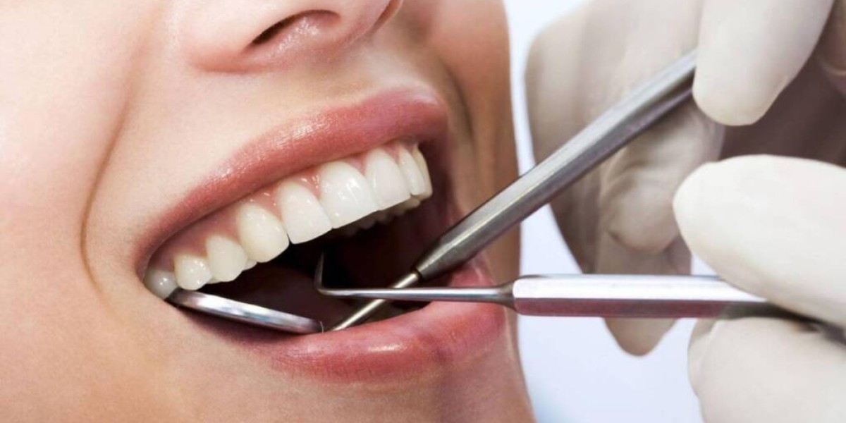 Which Factors Cause Tooth Filling Cost in Dubai to Vary?