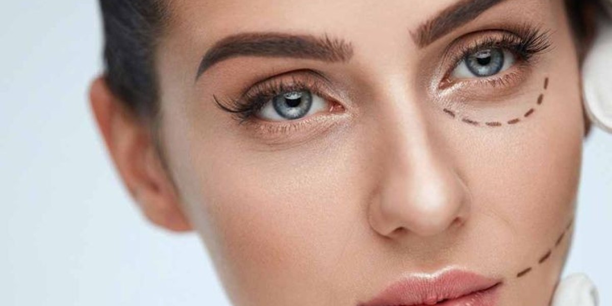 What Is Eyelid Surgery? A Complete Guide for Beginners in Islamabad