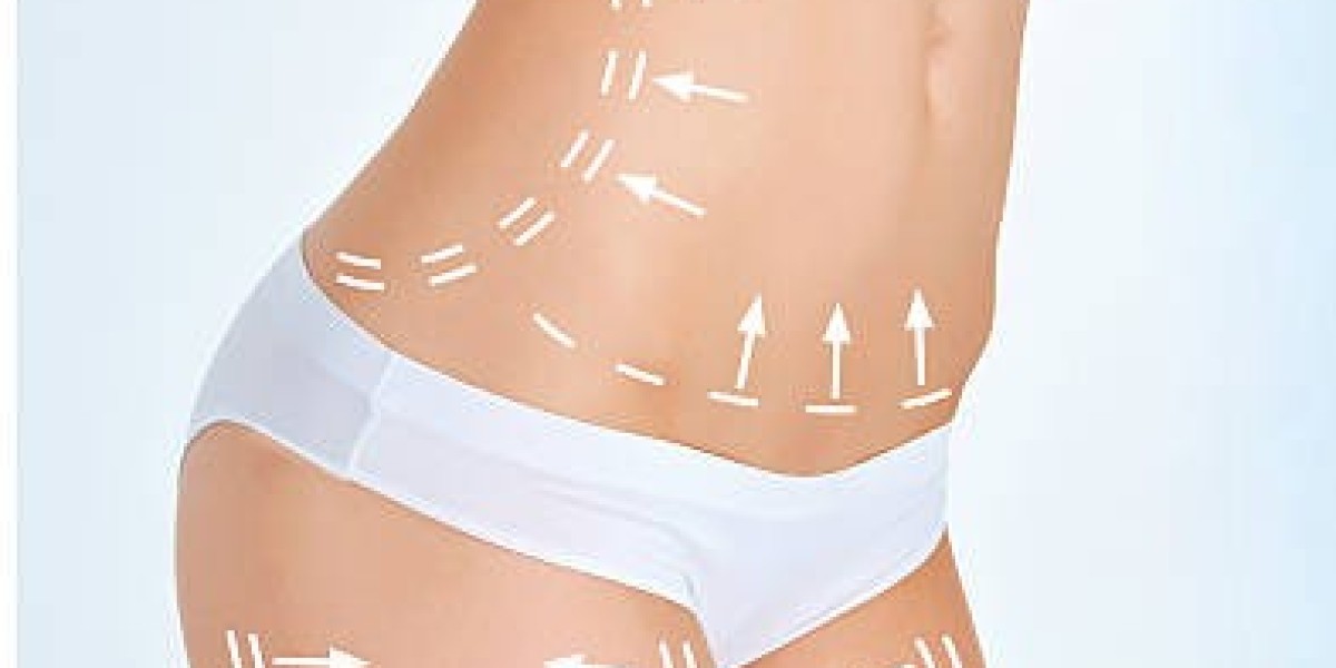 Benefits of Choosing a Customized Body Sculpting Procedure