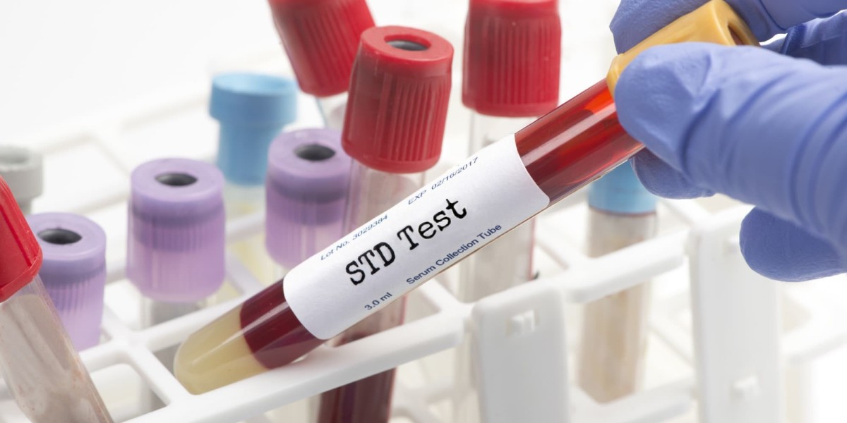 STD Test in Dubai: What Makes Early Testing So Effective