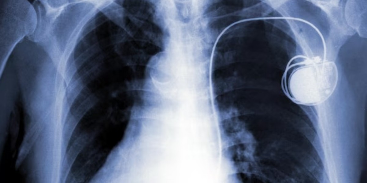 Pacemakers Market - Market Analysis, Size, Share, Growth, Trends and Forecast – 2028