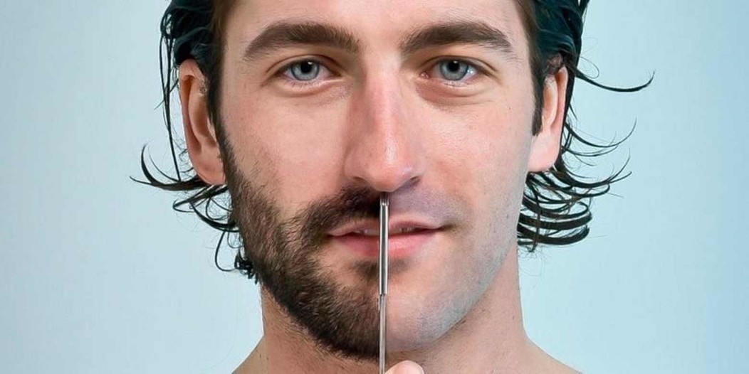 Beard Hair Transplant in Dubai