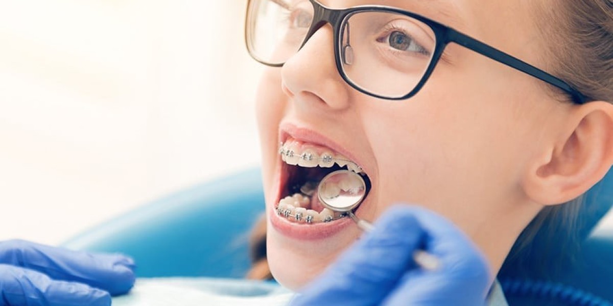 Metal Braces: Before, During, and After – What to Expect