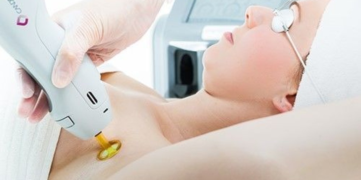 Laser Hair Removal in Dubai: Why Professional Care Matters