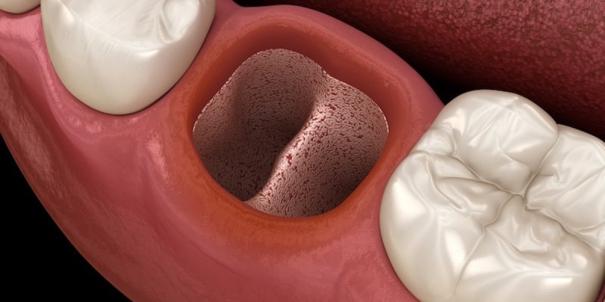 Tooth Extraction Cost: Why Early Treatment Matters