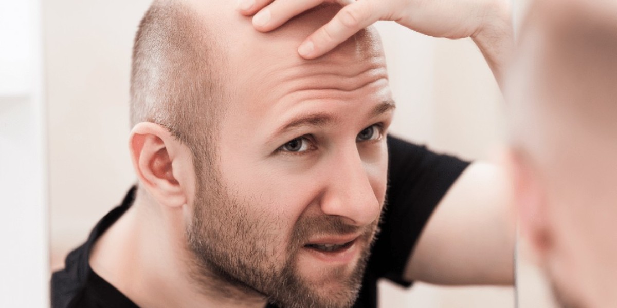 Best PRP Hair Treatment: Why It’s Becoming a Hair Care Trend