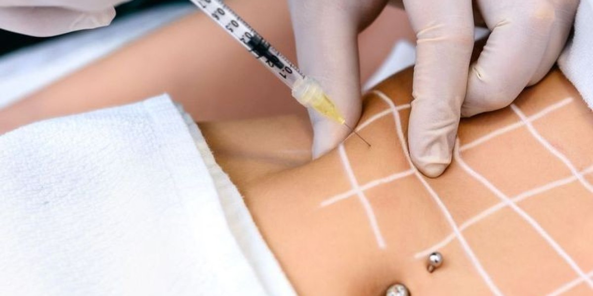 Fat Melting Injection in Dubai for Arms: Can It Tone Flabby Areas?