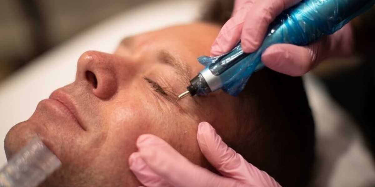 How Is Plasma Pen Treatment Performed?