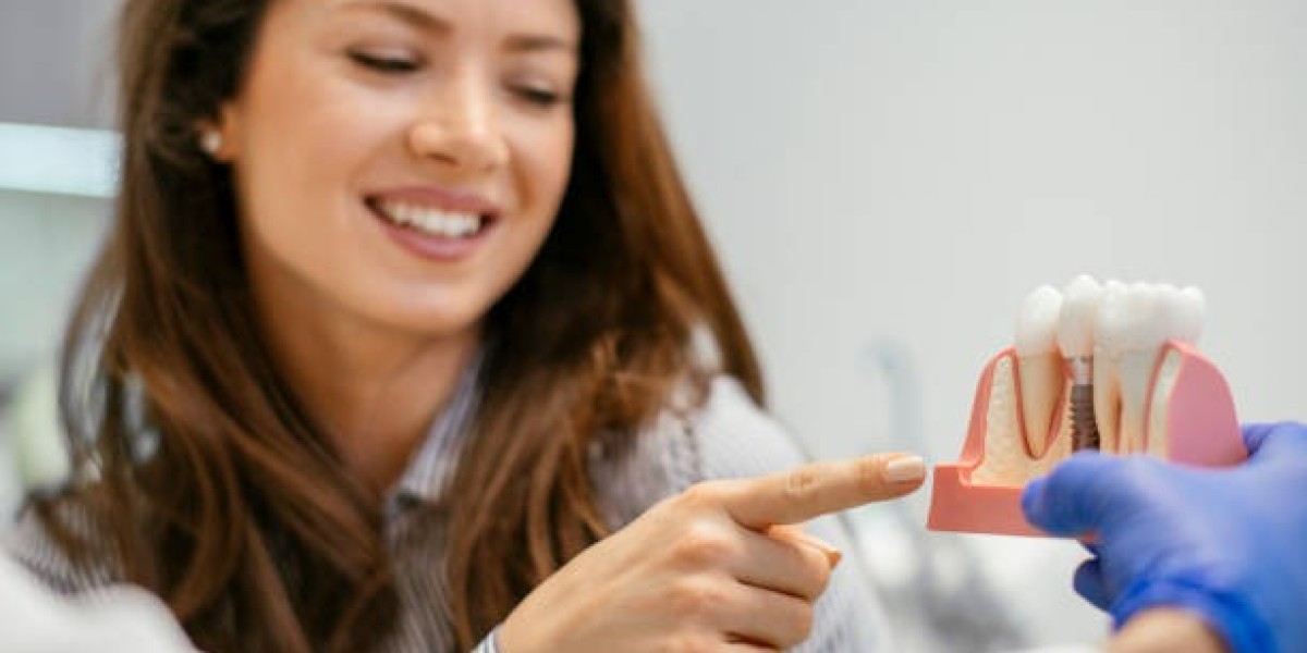 Everything New Yorkers Should Know Before Fixing A Missing Tooth