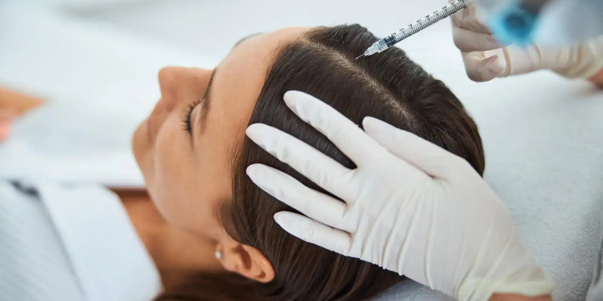 Lift Hair Volume With Targeted PRP Hair Treatment Cost Solutions