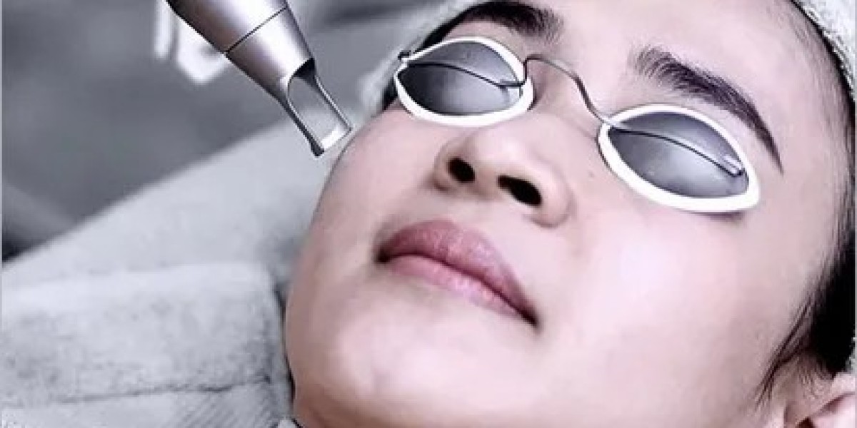FRACTIONAL CO2 LASER TREATMENT: Renew and Rejuvenate Your Skin